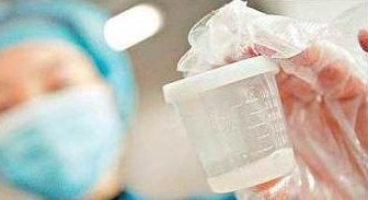 试管促排方案哪种更适合你？如何根据个人情况选择最合适的试管婴儿促排卵方案？