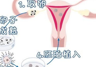 武汉同济医院做试管怎么样？附武汉同济医院三代试管助孕费用明细