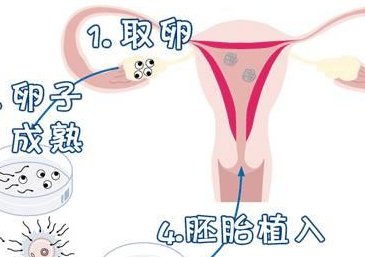 泰国第三特需前需要做什么？黄体酮不足该怎么办？